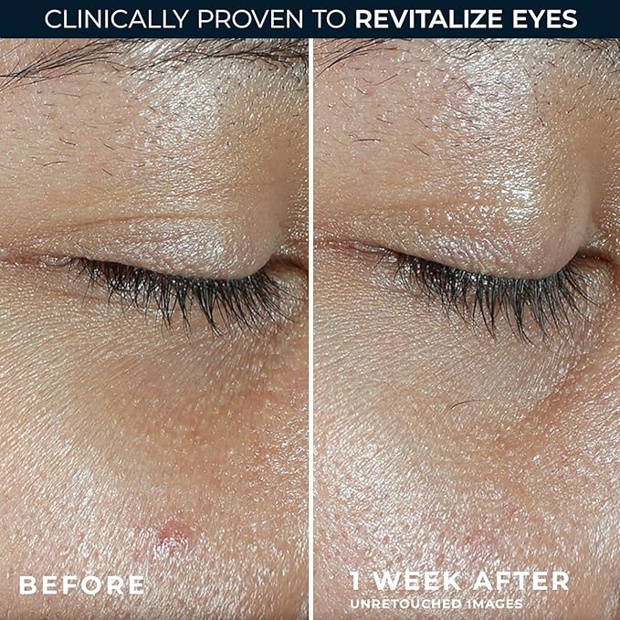 RoC Multi Correxion Revive + Glow Eye Balm with Vitamin C (0.14 oz) + Retinol Eye Cream Packette