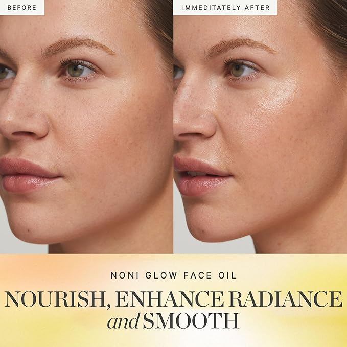 KORA Organics Noni Glow Hydrating Face Oil for All Skin Types, Lightweight Fast-Absorbing Facial Oil with Rosehip, Jojoba & Sea Buckthorn Oils for Smooth & Radiant Looking Skin, 0.34 fl oz