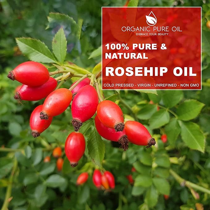 Rosehip Oil - 32 oz - Pure, Unrefined, Cold Pressed, Raw, Unfiltered, Virgin for Skin, Hair, Nails, Body, Face - For All Skin Types - Organic Pure Oil