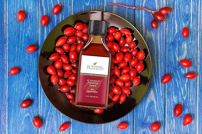 Au Natural Organics Rosehip Oil - Natural Source of Vitamin A - Face & Body Skin Moisturizer - Cleansing & Anti-Aging Power - 3.4oz / 100ml